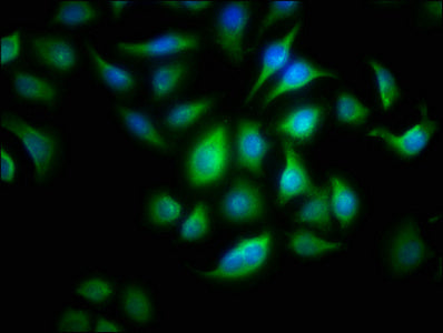 Immunofluorescence staining of A549 cells with CSB-PA001622LA01HU at 1:166, counter-stained with DAPI. The cells were fixed in 4% formaldehyde, permeabilized using 0.2% Triton X-100 and blocked in 10% normal Goat Serum. The cells were then incubat...