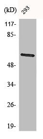 Western Blot analysis of 293 cells using Chk2 Polyclonal Antibody
