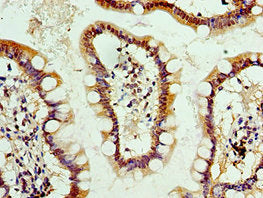 Immunohistochemistry of paraffin-embedded human small intestine tissue using CSB-PA001631ESR2HU at dilution of 1:100
