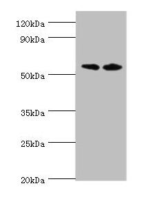 Western blot All lanes: Alkaline phosphatase, placental type antibody at 8ug/ml Lane 1: A549 whole cell lysate Lane 2: Hela whole cell lysate Secondary Goat polyclonal to rabbit IgG at 1/10000 dilution Predicted band size: 58 kDa Observed band siz...