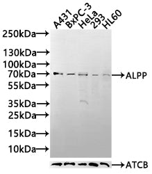 Western blot All lanes: Alkaline phosphatase, placental type antibody at 6ug/ml Lane 1: A549 whole cell lysate Lane 2: Hela whole cell lysate Secondary Goat polyclonal to rabbit IgG at 1/10000 dilution Predicted band size: 58 kDa Observed band siz...