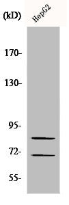 Western Blot analysis of HepG2 cells using Choactase Polyclonal Antibody