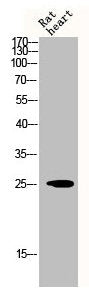 Western Blot analysis of RAT-HEART cells using CHOP Polyclonal Antibody