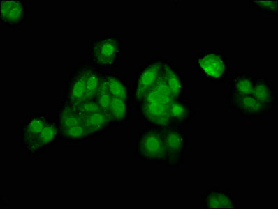 Immunofluorescence staining of HepG2 cells with CSB-PA001646LA01HU at 1:133, counter-stained with DAPI. The cells were fixed in 4% formaldehyde, permeabilized using 0.2% Triton X-100 and blocked in 10% normal Goat Serum. The cells were then incuba...