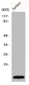 Western Blot analysis of Jurkat cells using Cks1 Polyclonal Antibody