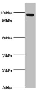 Western blot All lanes: Angiomotin antibody at 2ug/ml + 293T whole cell lysate Secondary Goat polyclonal to rabbit IgG at 1/10000 dilution Predicted band size: 119, 73 kDa Observed band size: 119 kDa