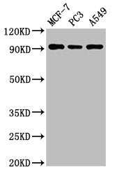 Western Blot Positive WB detected in: MCF-7 whole cell lysate, PC-3 whole cell lysate, A549 whole cell lysate All lanes: AMPD1 antibody at 3ug/ml Secondary Goat polyclonal to rabbit IgG at 1/50000 dilution Predicted band size: 91, 90 kDa Observed...