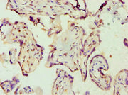 Immunohistochemistry of paraffin-embedded human placenta tissue using CSB-PA001682ESR2HU at dilution of 1:100