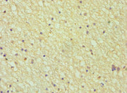 Immunohistochemistry of paraffin-embedded human brain tissue using CSB-PA001683DSR1HU at dilution of 1:100