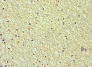 Immunohistochemistry of paraffin-embedded human brain tissue using CSB-PA001683DSR1HU at dilution of 1:100