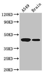 Western Blot Positive WB detected in: A549 whole cell lysate, Mouse brain tissue All lanes: AMT antibody at 3.5µg/ml Secondary Goat polyclonal to rabbit IgG at 1/50000 dilution Predicted band size: 44, 38, 40, 42 kDa Observed band size: 44 kDa