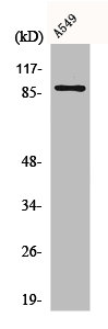 Western Blot analysis of LOVO cells using CLC-7 Polyclonal Antibody