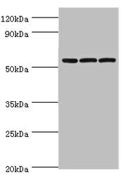 Western blot All lanes: Alpha-amylase 2B antibody at 8ug/ml Lane 1: Mouse skeletal muscle tissue Lane 2: HL60 whole cell lysate Lane 3: K562 whole cell lysate Secondary Goat polyclonal to rabbit IgG at 1/10000 dilution Predicted band size: 58, 43...