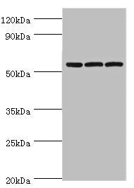 Western blot All lanes: Alpha-amylase 2B antibody at 8ug/ml Lane 1: Mouse skeletal muscle tissue Lane 2: HL60 whole cell lysate Lane 3: K562 whole cell lysate Secondary Goat polyclonal to rabbit IgG at 1/10000 dilution Predicted band size: 58, 43...