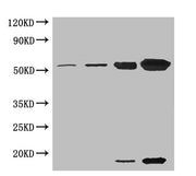 Western blot All lanes: Ribulose-1,5-bisphosphate carboxylase oxygenase antibody at 5µg/ml Lane 1: Ribulose-1,5-bisphosphate carboxylase oxygenase at 0.01µg/ml Lane 2: Ribulose-1,5-bisphosphate carboxylase oxygenase at 0.1µg/ml Lane 3: Ribulose-1,...