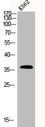 Western Blot analysis of K562 cells using CLP36 Polyclonal Antibody