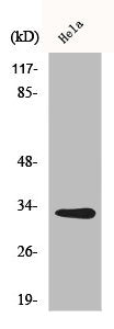 Western Blot analysis of HuvEc cells using CNOT7 Polyclonal Antibody