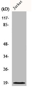 Western Blot analysis of Jurkat cells using Cofilin Polyclonal Antibody