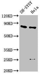 Western Blot Positive WB detected in: SH-SY5Y whole cell lysate, Hela whole cell lysate All lanes: CTNNB1 antibody at 2.5µg/ml Secondary Goat polyclonal to rabbit IgG at 1/50000 dilution Predicted band size: 86 kDa Observed band size: 86 kDa
