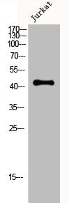 Western Blot analysis of Jurkat cells using Creatine Kinase M Polyclonal Antibody