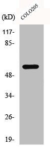 Western Blot analysis of COLO205 cells using c-Src Polyclonal Antibody
