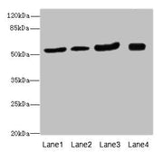 Western blot All lanes: ANTXR2antibody at 1.24ug/ml Lane 1: Mouse lung tissue Lane 2: Mouse gonadal tissue Lane 3: Mouse kidney tissue Lane 4: Mouse small intestine tissue Secondary Goat polyclonal to rabbit IgG at 1/10000 dilution Predicted band...
