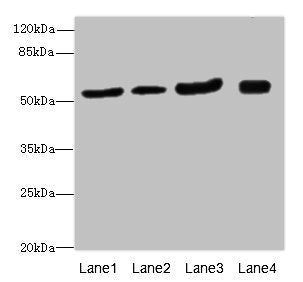 Western blot All lanes: ANTXR2antibody at 1.24ug/ml Lane 1: Mouse lung tissue Lane 2: Mouse gonadal tissue Lane 3: Mouse kidney tissue Lane 4: Mouse small intestine tissue Secondary Goat polyclonal to rabbit IgG at 1/10000 dilution Predicted band...