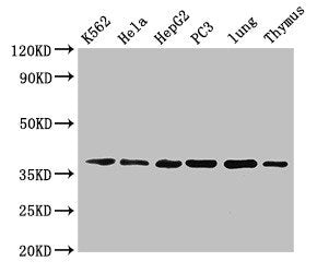 Western Blot Positive WB detected in: K562 whole cell lysate, Hela whole cell lysate, HepG2 whole cell lysate, PC-3 whole cell lysate, Mouse lung tissue, Mouse thymus tissue All lanes: Anxa1 antibody at 5µg/ml Secondary Goat polyclonal to rabbit I...