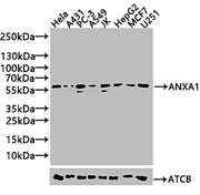 Western Blot Positive WB detected in: Hela whole cell lysate(20µg), A431 whole cell lysate(20µg), PC-3 whole cell lysate(20µg), A549 whole cell lysate(20µg), JK whole cell lysate(20µg), HepG2 whole cell lysate(20µg),MCF7 whole cell lysate(20µg),U2...