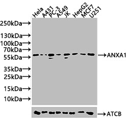 Western Blot Positive WB detected in: Hela whole cell lysate(20µg), A431 whole cell lysate(20µg), PC-3 whole cell lysate(20µg), A549 whole cell lysate(20µg), JK whole cell lysate(20µg), HepG2 whole cell lysate(20µg),MCF7 whole cell lysate(20µg),U2...