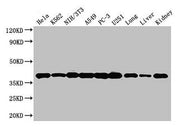 Western Blot Positive WB detected in: Hela whole cell lysate, K562 whole cell lysate, NIH/3T3 whole cell lysate, A549 whole cell lysate, PC-3 whole cell lysate, U251 whole cell lysate, Mouse lung tissue, Mouse liver tissue, Mouse kidney tissue All...