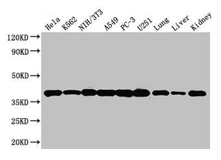Western Blot Positive WB detected in: Hela whole cell lysate, K562 whole cell lysate, NIH/3T3 whole cell lysate, A549 whole cell lysate, PC-3 whole cell lysate, U251 whole cell lysate, Mouse lung tissue, Mouse liver tissue, Mouse kidney tissue All...