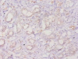 Immunohistochemistry of paraffin-embedded human kidney tissue using CSB-PA001844YA01HU at dilution of 1:20