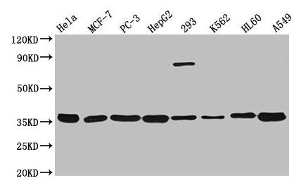 Western Blot Positive WB detected in: Hela whole cell lysate, MCF-7 whole cell lysate, PC-3 whole cell lysate, HepG2 whole cell lysate, 293 whole cell lysate, K562 whole cell lysate, HL60 whole cell lysate, A549 whole cell lysate All lanes: ANXA5...