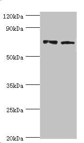 Western blot All lanes: Annexin A6 antibody at 4ug/ml Lane 1: Jurkat whole cell lysate Lane 2: Hela whole cell lysate Secondary Goat polyclonal to rabbit IgG at 1/10000 dilution Predicted band size: 76, 73 kDa Observed band size: 76 kDa