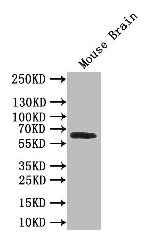 Western Blot Positive WB detected in:Mouse Brain tissue lysate All lanes: AOAH antibody at 1:1000 Secondary Goat polyclonal to rabbit IgG at 1/50000 dilution Predicted band size: 66 kDa Observed band size: 66 kDa