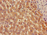 Immunohistochemistry of paraffin-embedded human liver tissue using CSB-PA001858HA01HU at dilution of 1:100