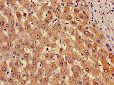 Immunohistochemistry of paraffin-embedded human liver tissue using CSB-PA001858HA01HU at dilution of 1:100
