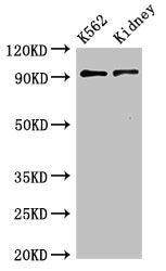 Western Blot Positive WB detected in:K562 whole cell lysate,Mouse kidney tissue All lanes:AP1G1 antibody at 3.4µg/ml Secondary Goat polyclonal to rabbit IgG at 1/50000 dilution Predicted band size: 92 KDa Observed band size: 92 KDa