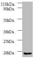 Western blot All lanes: AP1S3 antibody at 2µg/ml + A549 whole cell lysate Secondary Goat polyclonal to rabbit IgG at 1/10000 dilution Predicted band size: 19, 20, 13 kDa Observed band size: 19 kDa