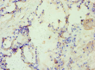 Immunohistochemistry of paraffin-embedded human prostate tissue using CSB-PA001869ESR1HU at dilution of 1:100