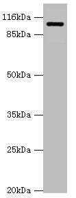 Western blot All lanes: AP2A2 antibody at 0.61ug/ml + Mouse brain tissue Secondary Goat polyclonal to rabbit IgG at 1/10000 dilution Predicted band size: 104, 105, 74 kDa Observed band size: 104 kDa