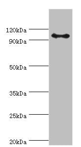 Western blot All lanes: AP-2 complex subunit beta antibody at 8ug/ml + Mouse brain tissue Secondary Goat polyclonal to rabbit IgG at 1/10000 dilution Predicted band size: 105, 106, 99 kDa Observed band size: 105 kDa