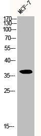 Western Blot analysis of MCF-7 cells using Cyclin D1 Polyclonal Antibody