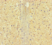 Immunohistochemistry of paraffin-embedded human adrenal gland tissue using CSB-PA001878LA01HU at dilution of 1:100