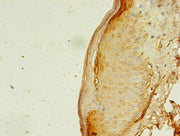 Immunohistochemistry of paraffin-embedded human skin tissue using CSB-PA001885LA01HU at dilution of 1:100