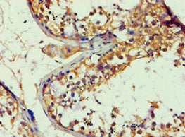 Immunohistochemistry of paraffin-embedded human testis tissue using CSB-PA001890ESR2HU at dilution of 1:100