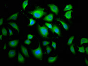 Immunofluorescence staining of A549 cells with CSB-PA001895LA01HU at 1:166, counter-stained with DAPI. The cells were fixed in 4% formaldehyde, permeabilized using 0.2% Triton X-100 and blocked in 10% normal Goat Serum. The cells were then incubat...