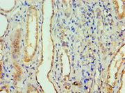 Immunohistochemistry of paraffin-embedded human kidney tissue using CSB-PA001898ESR1HU at dilution of 1:100
