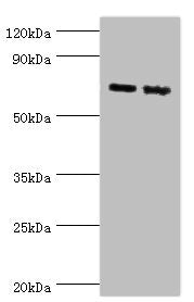 Western blot All lanes: Amyloid-like protein 1 antibody at 6ug/ml Lane 1: Mouse brain tissue Lane 2: A549 whole cell lysate Secondary Goat polyclonal to rabbit IgG at 1/10000 dilution Predicted band size: 72 kDa Observed band size: 72 kDa